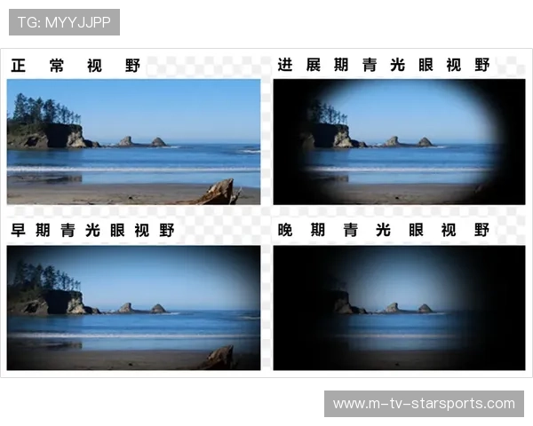 职业选手的视野布置：他是如何通过多视角布点保障安全的